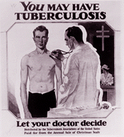 You May Have TB